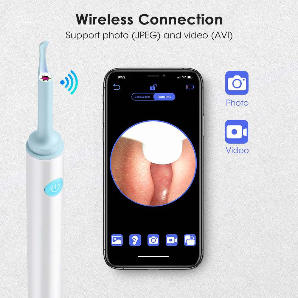 Qpix Visual Ear Cleaning Pick