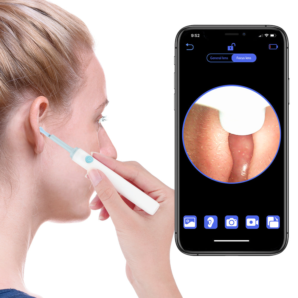 Qpix Visual Ear Cleaning Pick