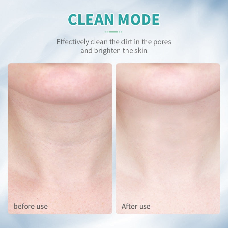 Microfin™ Face Sculpting Handset